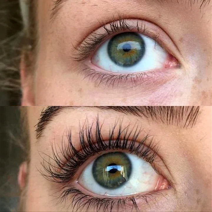 Előtte és utána fotó, amely drámai szempillanövekedést és dúsabb hatást mutat a QUALASH Advanced Eyelash Serum használatával