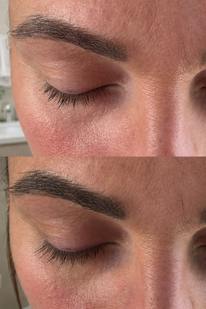 Ser activator pentru gene cu peptide