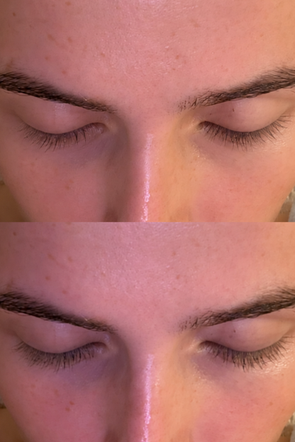 Ser activator pentru gene cu peptide
