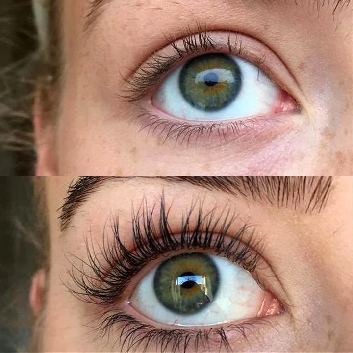 Before and after photo showing dramatic eyelash growth and volume enhancement with QUALASH Advanced Eyelash Serum